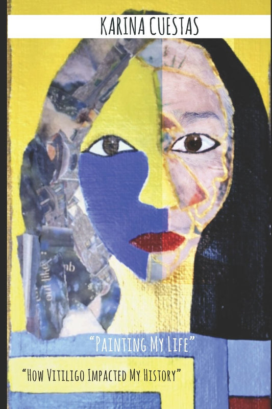 " Painting My Life" " How Vitiligo Impacted my history."